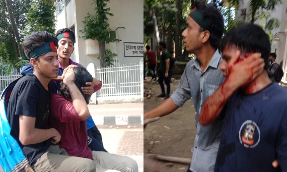 Chhatra League attacks quota protesters at DU 